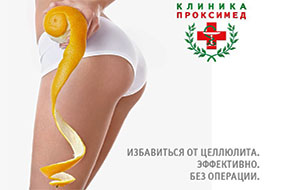 лечение целлюлита